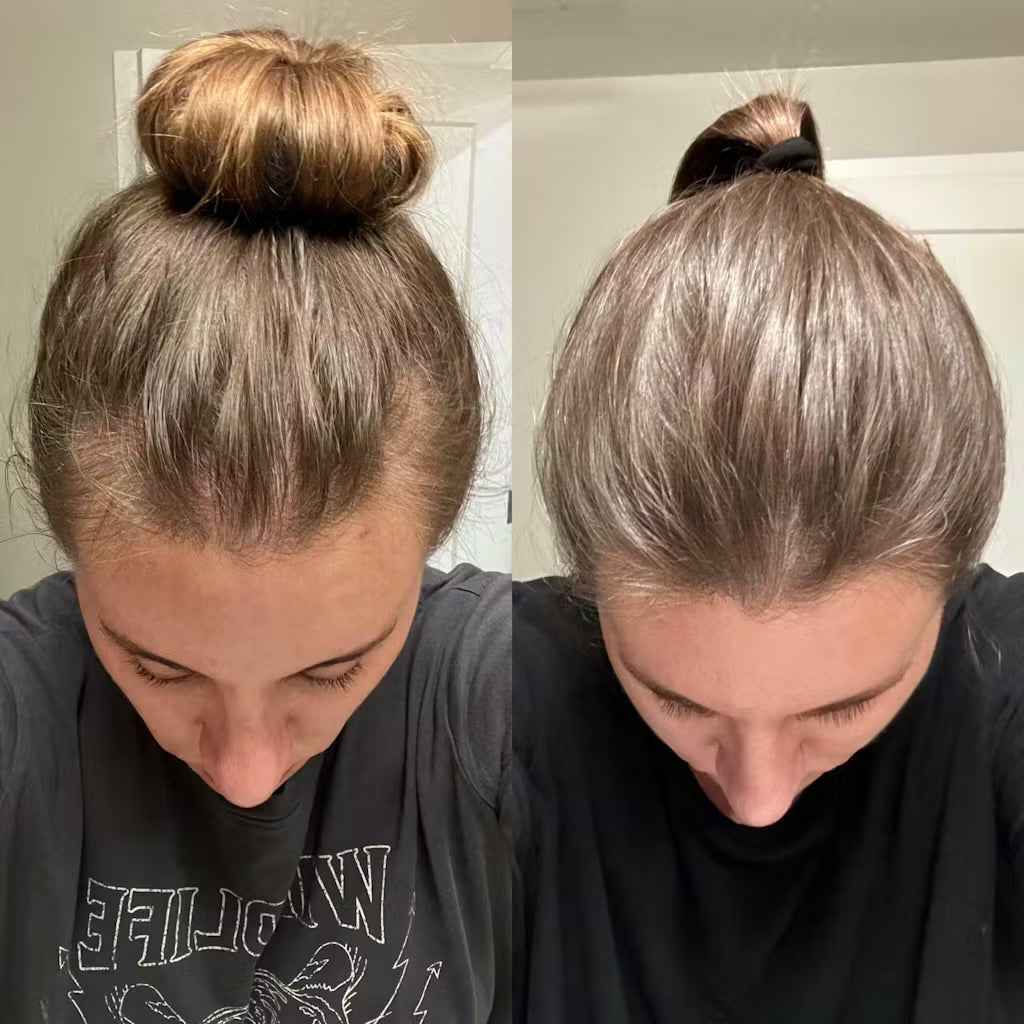 ShinyHair | Relaxing Kit