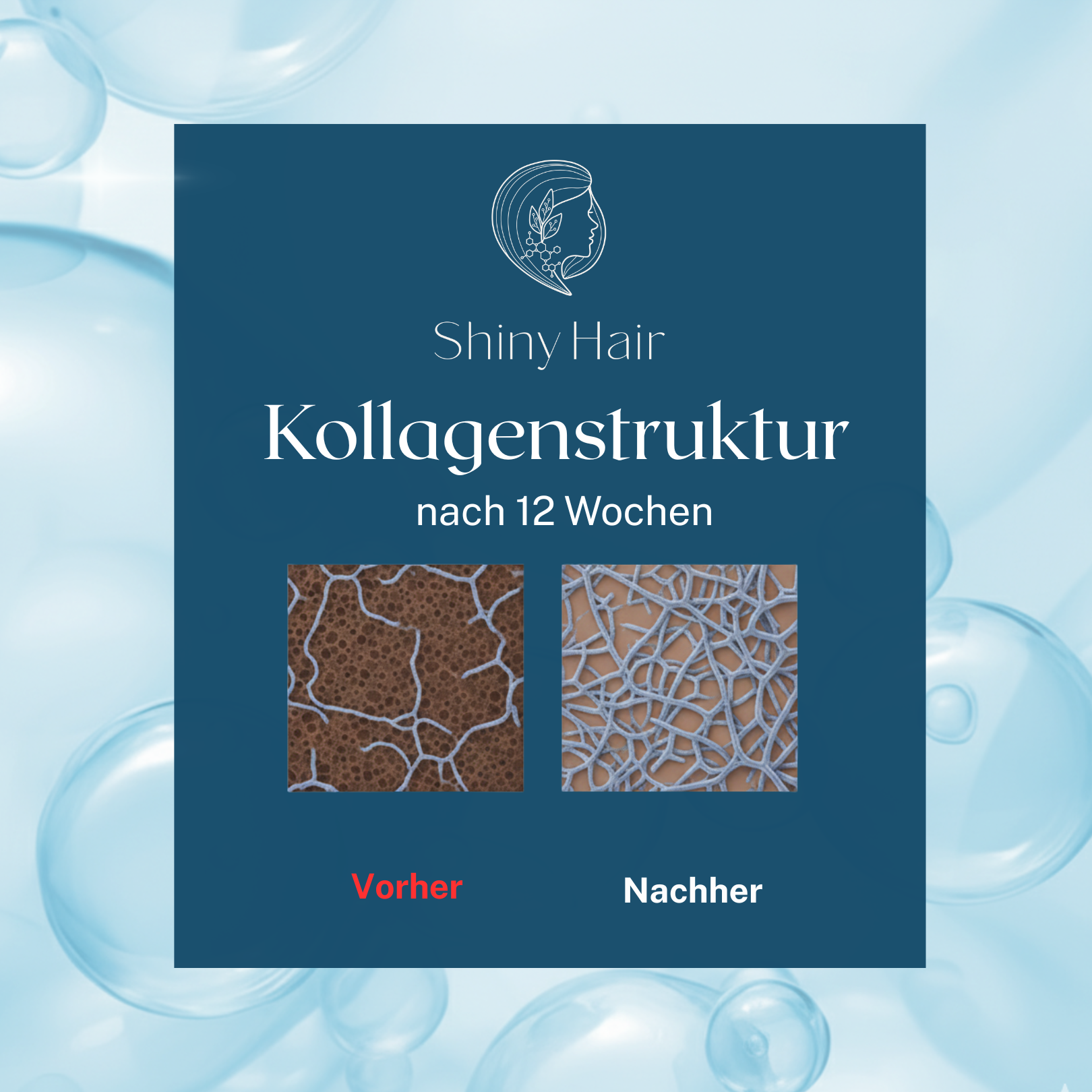 ShinyHair Premium Kollagenpulver