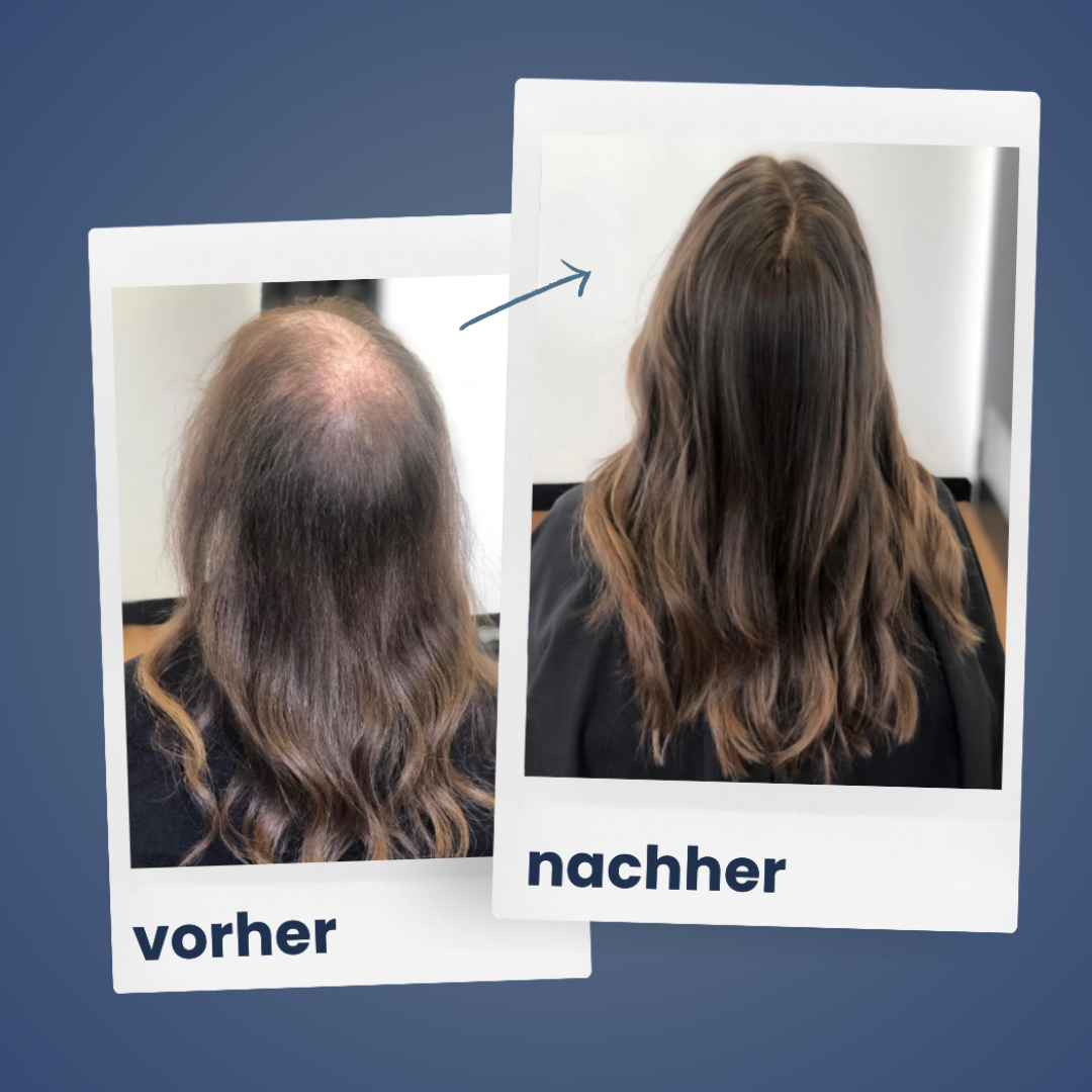 ShinyHair | Repair Kit