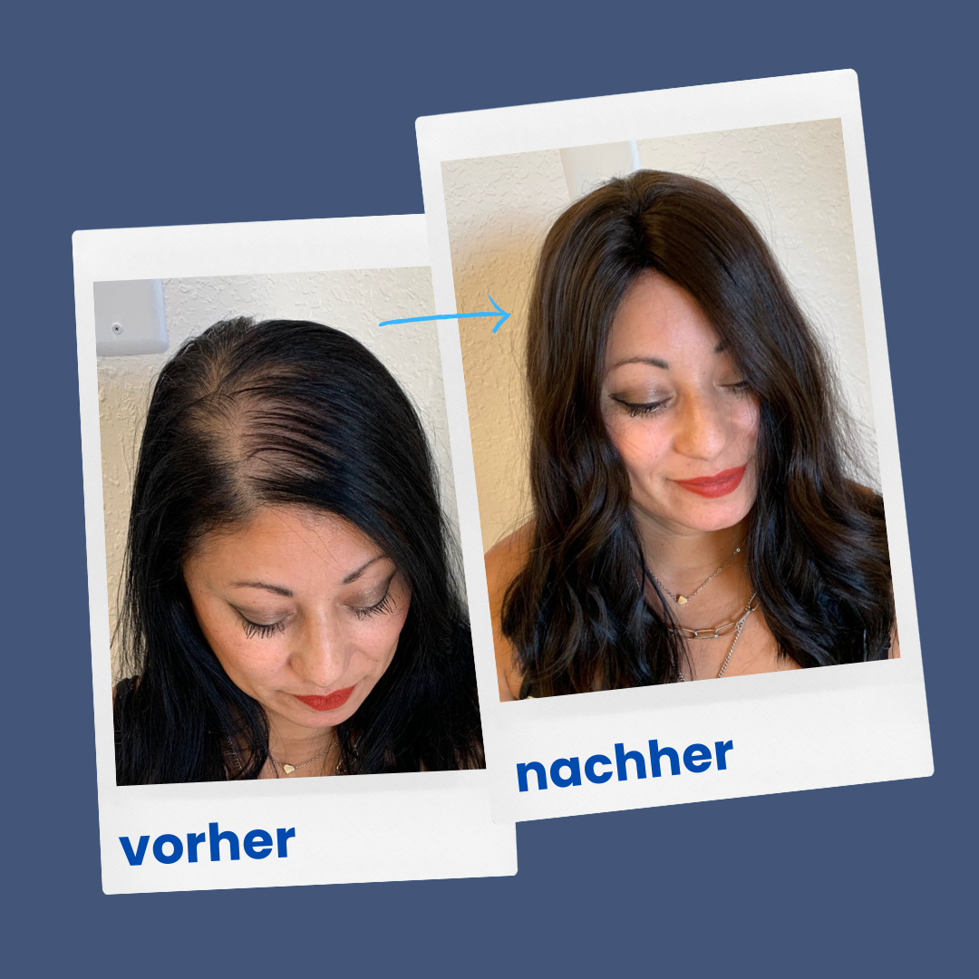 ShinyHair Haarwuchsbooster