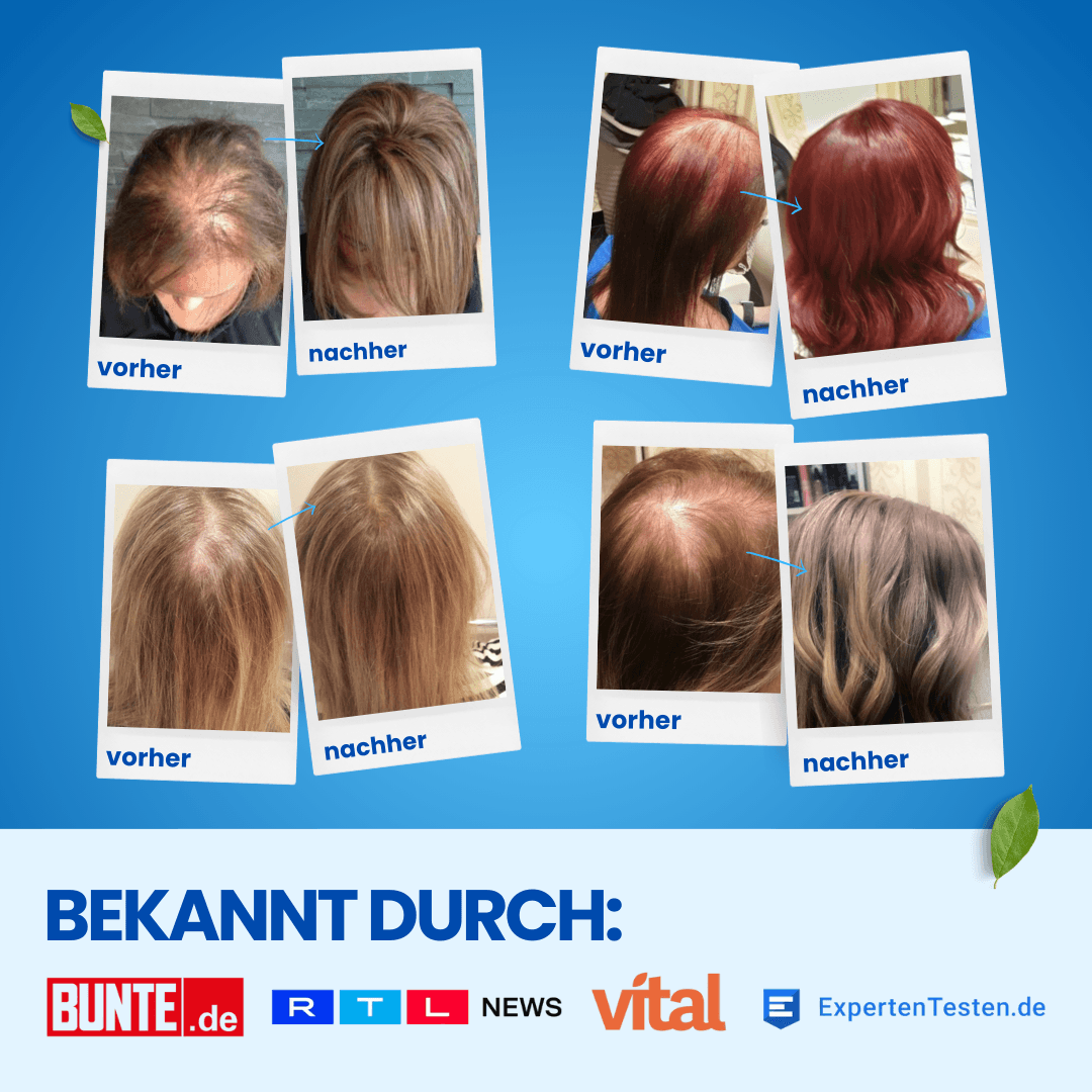 ShinyHair Haarwuchsbooster Sale