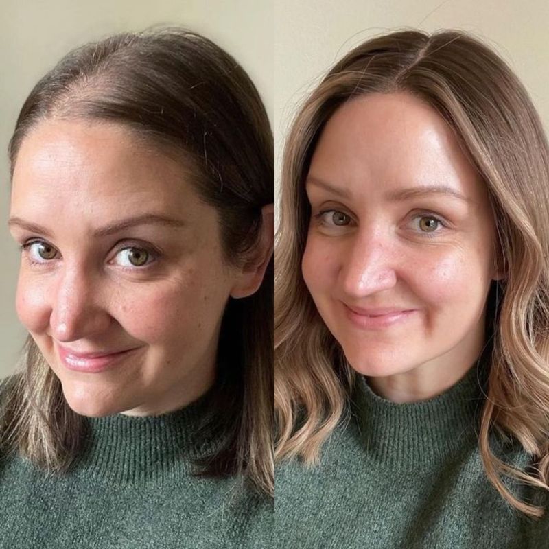 ShinyHair | Growth Kit